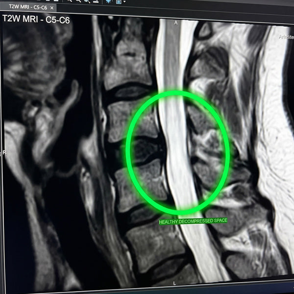 Before / After image