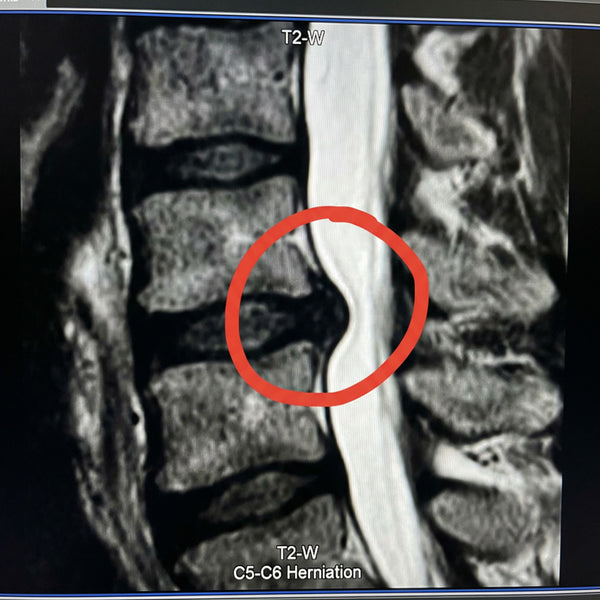 Before / After image