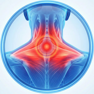Neck Stiffness