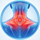 Neck Stiffness