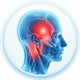 Tension Headaches