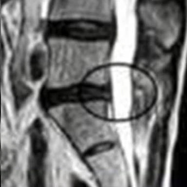 After Treatment