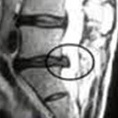 Before Treatment