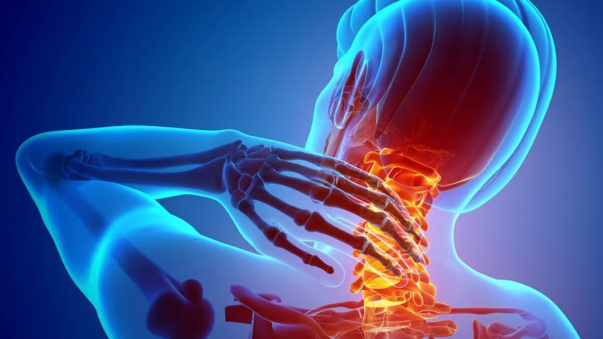 Molestia cervical por rutina diaria
