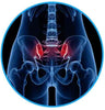 Pelvic pain